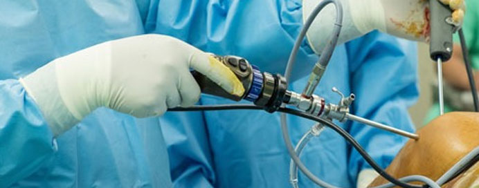 Knee & Shoulder Arthroscopy
