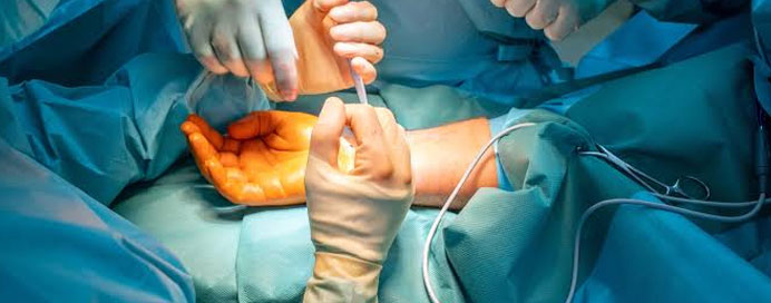 Hand Surgery